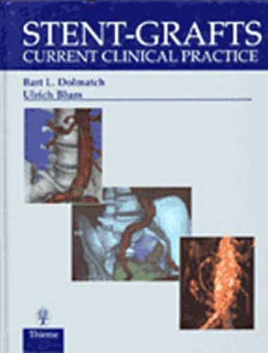 Cover image for Stent-Grafts: Current Clinical Practice