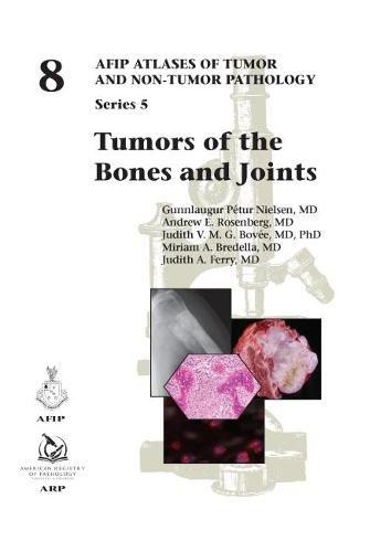 Cover image for Tumors of the Bones and Joints