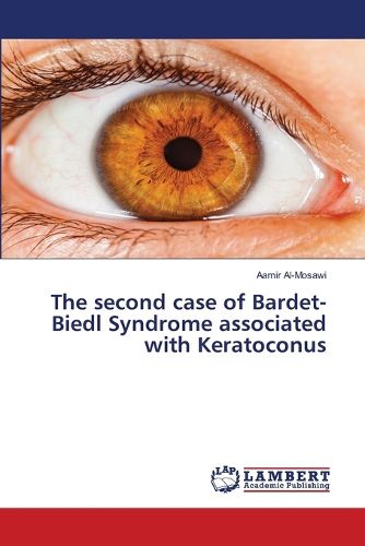 Cover image for The second case of Bardet-Biedl Syndrome associated with Keratoconus