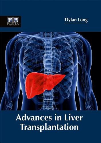 Cover image for Advances in Liver Transplantation