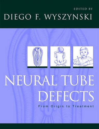 Cover image for Neural Tube Defects: From origin to treatment