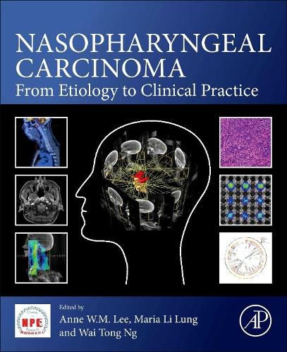 Cover image for Nasopharyngeal Carcinoma: From Etiology to Clinical Practice