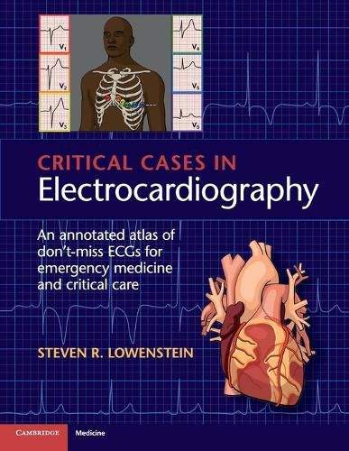 Cover image for Critical Cases in Electrocardiography: An Annotated Atlas of Don't-Miss ECGs for Emergency Medicine and Critical Care