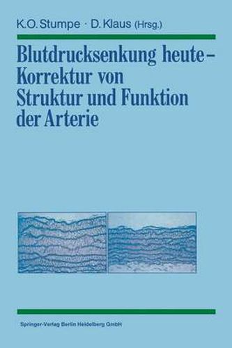 Blutdrucksenkung Heute -- Korrektur Von Struktur Und Funktion Der Arterie