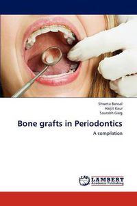 Cover image for Bone grafts in Periodontics