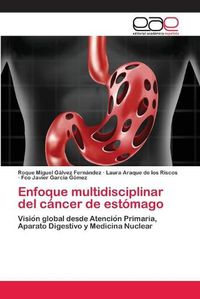 Cover image for Enfoque multidisciplinar del cancer de estomago