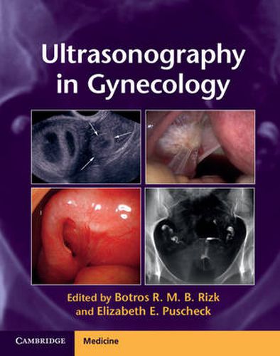 Cover image for Ultrasonography in Gynecology