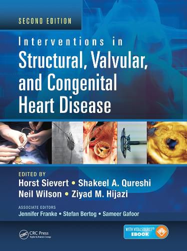 Cover image for Interventions in Structural, Valvular and Congenital Heart Disease