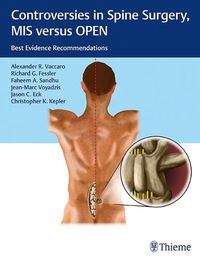 Cover image for Controversies in Spine Surgery, MIS versus OPEN: Best Evidence Recommendations
