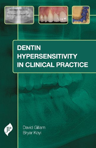 Cover image for Dentin Hypersensitivity in Clinical Practice