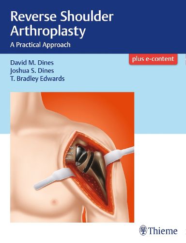 Cover image for Reverse Shoulder Arthroplasty: A Practical Approach