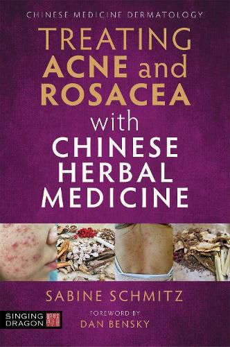 Treating Acne and Rosacea with Chinese Herbal Medicine