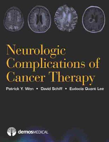 Cover image for Neurologic Complications of Cancer Therapy