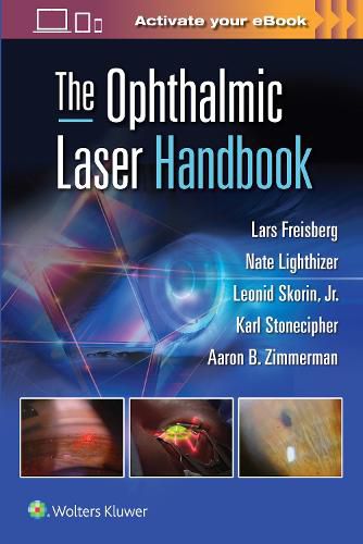 Cover image for The Ophthalmic Laser Handbook