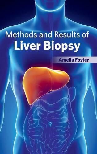 Cover image for Methods and Results of Liver Biopsy