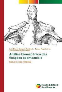 Cover image for Analise biomecanica das fixacoes atlantoaxiais