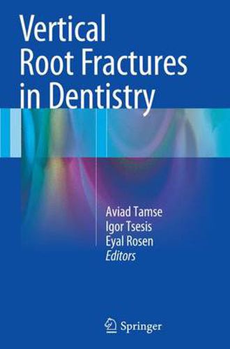 Cover image for Vertical Root Fractures in Dentistry