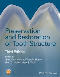 Cover image for Preservation and Restoration of Tooth Structure 3e