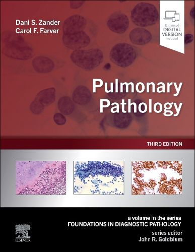 Cover image for Pulmonary Pathology