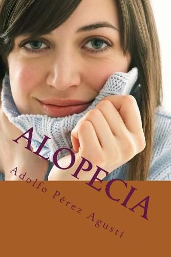 Cover image for Alopecia