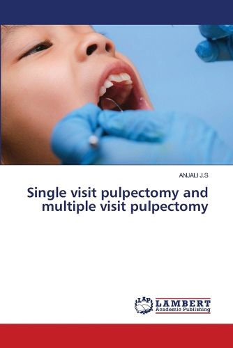 Cover image for Single visit pulpectomy and multiple visit pulpectomy