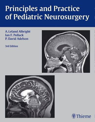 Cover image for Principles and Practice of Pediatric Neurosurgery