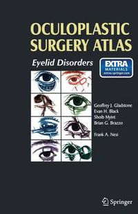 Cover image for Oculoplastic Surgery Atlas: Eyelid Disorders