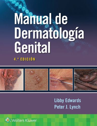 Cover image for Manual de dermatologia genital