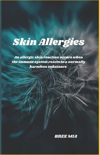 Cover image for Skin Allergies