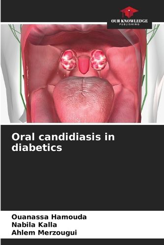 Cover image for Oral candidiasis in diabetics