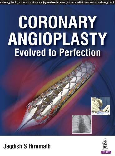 Cover image for Coronary Angioplasty: Evolved to Perfection