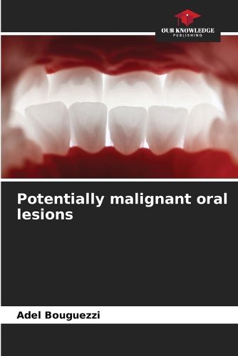 Cover image for Potentially malignant oral lesions