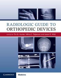 Cover image for Radiologic Guide to Orthopedic Devices