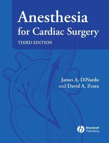 Cover image for Anesthesia for Cardiac Surgery