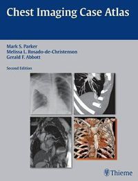 Cover image for Chest Imaging Case Atlas