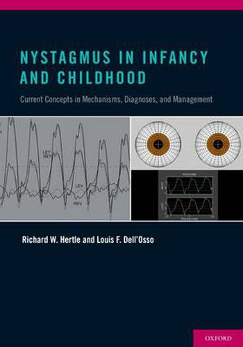 Cover image for Nystagmus In Infancy and Childhood: Current Concepts in Mechanisms, Diagnoses, and Management