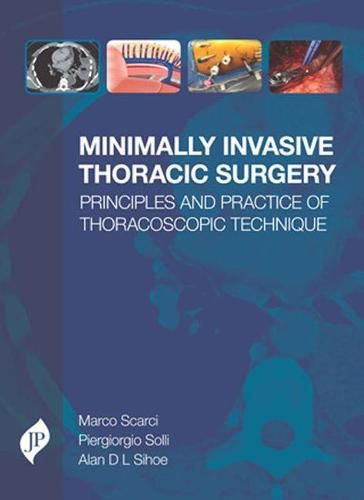 Cover image for Minimally Invasive Thoracic Surgery: Principles and Practice of Thoracoscopic Technique