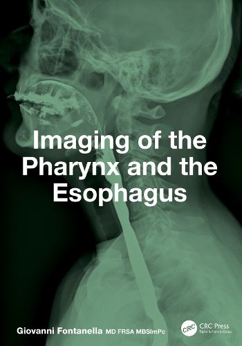 Cover image for Imaging of the Pharynx and the Esophagus