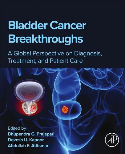 Cover image for Bladder Cancer Breakthroughs