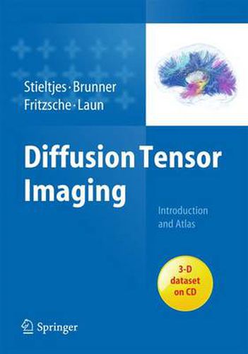 Cover image for Diffusion Tensor Imaging: Introduction and Atlas