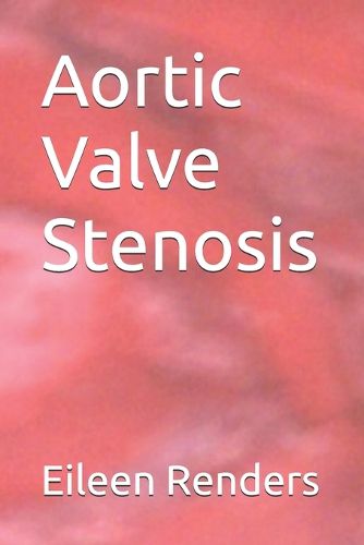 Cover image for Aortic Valve Stenosis