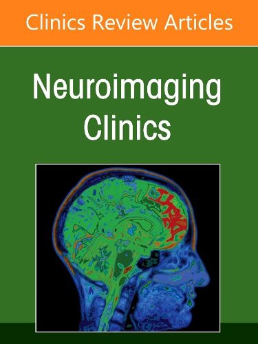 Cover image for Management and Treatment of Cerebral Aneurysms, An Issue of Neuroimaging Clinics of North America: Volume 35-3