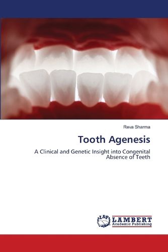 Cover image for Tooth Agenesis