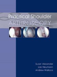 Cover image for Practical Shoulder Arthroscopy