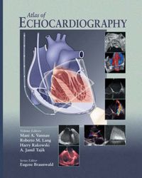 Cover image for Atlas of Echocardiography