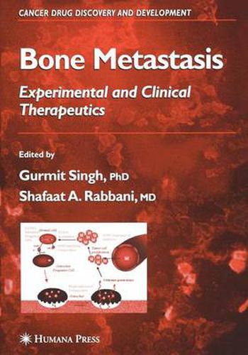 Cover image for Bone Metastasis