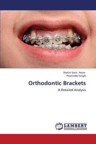 Cover image for Orthodontic Brackets