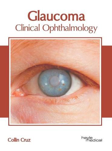 Cover image for Glaucoma: Clinical Ophthalmology