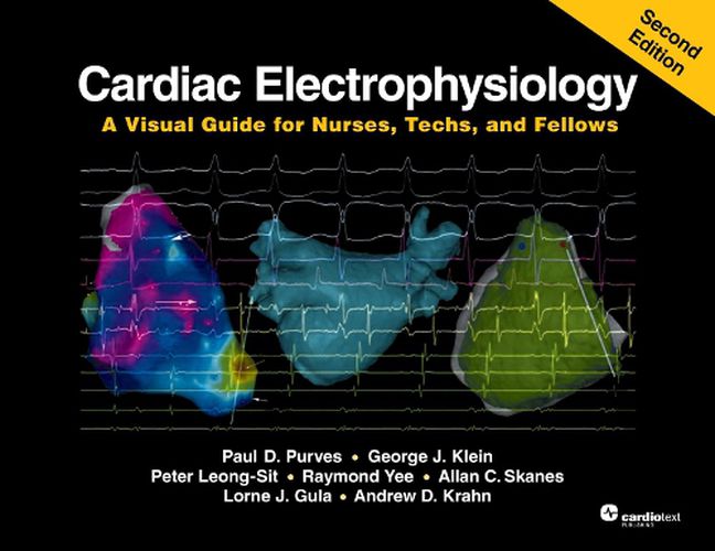 Cover image for Cardiac Electrophysiology , Second Edition: A Visual Guide for Nurses, Techs, and Fellows