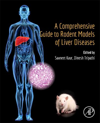 A Comprehensive Guide to Rodent Models of Liver Diseases